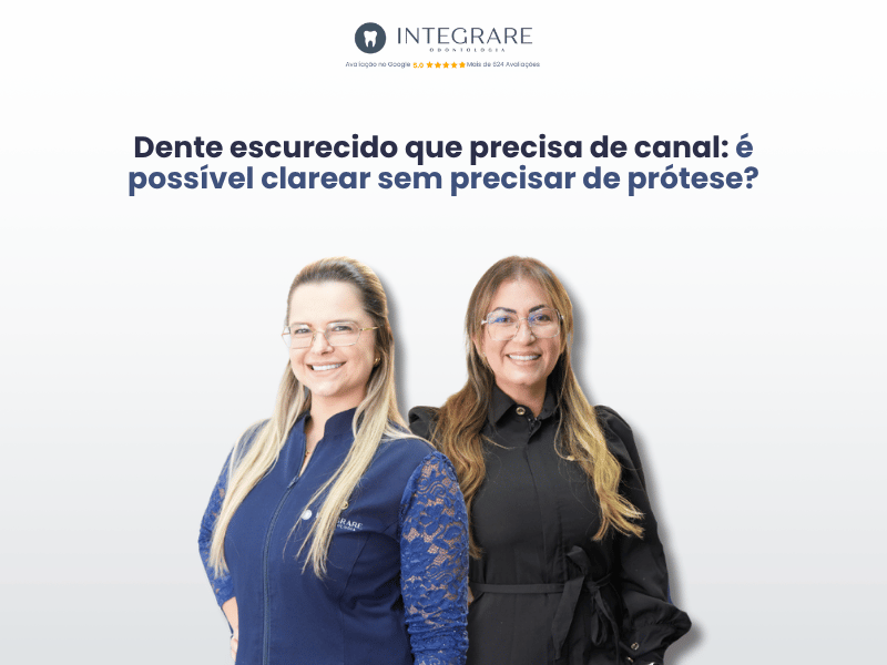 Dente escurecido que precisa de canal: é possível clarear sem precisar de prótese?