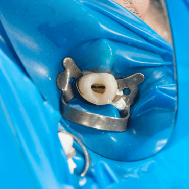 Endodontia em Tapete Verde
