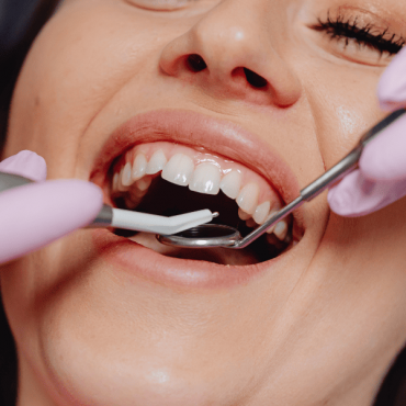 Tratamentos Odontológicos em Tapete Verde