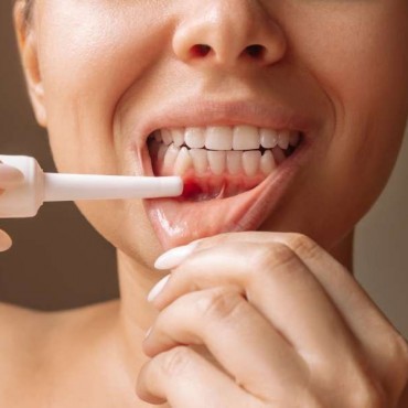 Periodontia em Tapete Verde